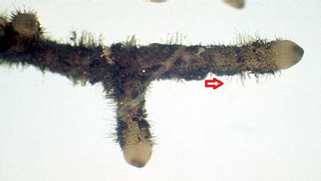 Rhizoids: Definition & Function - Video & Lesson Transcript | Study.com