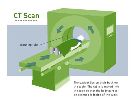 CT Scan (CAT) | CureSearch