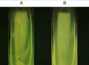 Cetrimide Agar: Composition, Preparation, Uses • Microbe Online