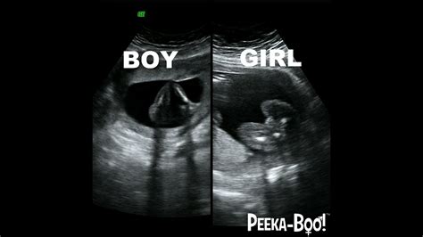 12 Week Ultrasound Girl Vs Boy