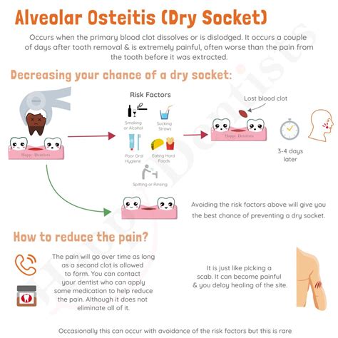 Dry Socket | Happy Dentists