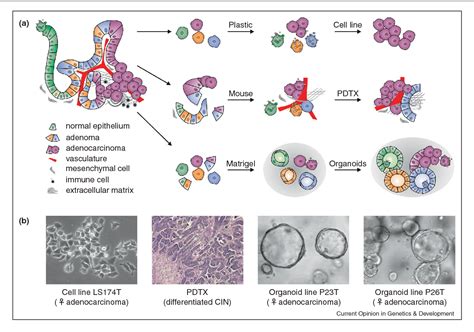 Organoid cultures for the analysis of cancer phenotypes. - Semantic Scholar