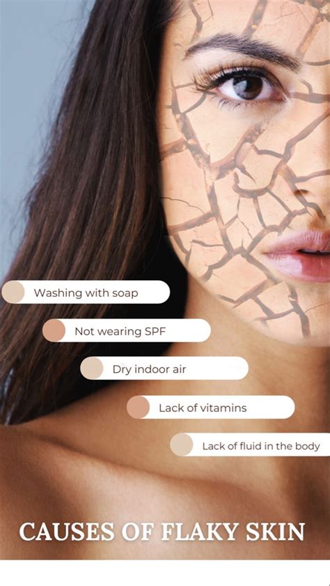 Causes of Flaky Skin | Skincare Tips