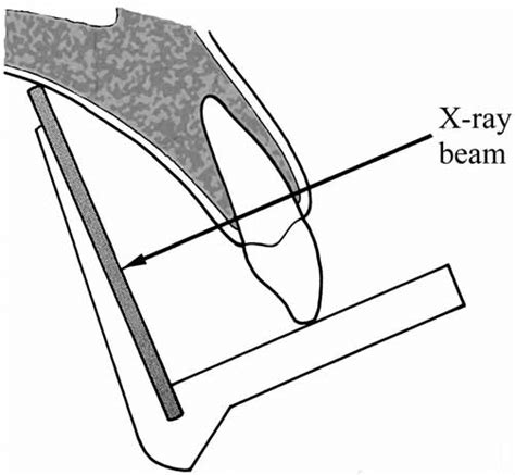 -Technique periapical radiographs. | Download Scientific Diagram