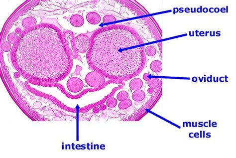 Ascaris Labeled Diagram