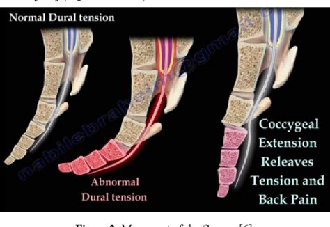 Coccydynia Treatment - Physiotherapy Victoria BC