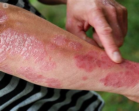 What causes a skin rash? | Top Doctors