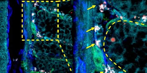 Study the Function of Stromal Cells through Intestinal Organoid Co ...