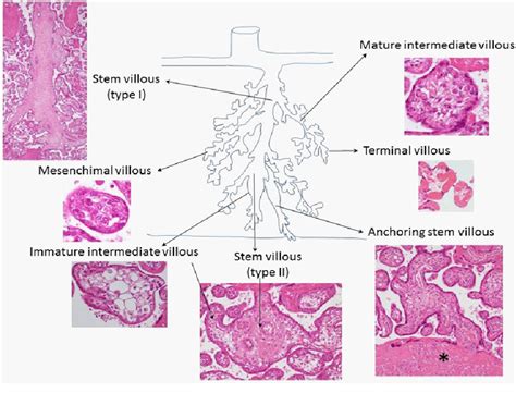 Figure 7 from Histology of Human Placenta | Semantic Scholar