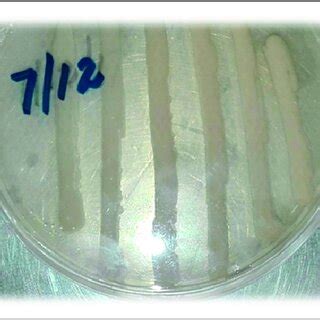 Growth of bacteria on nutrient agar plate isolated from soil ...