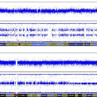 Examples of SNP array data from case 56. Top panels show log2 ratios... | Download Scientific ...