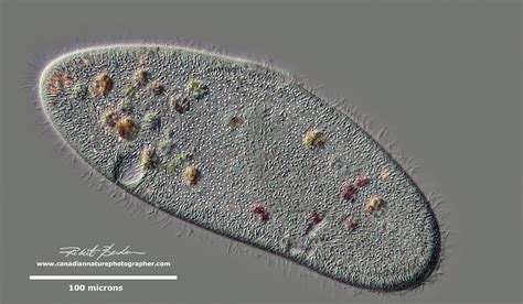 Ciliates Under Microscope