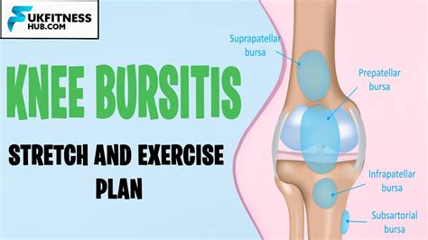 Stop Knee Bursitis Pain: Prepatellar, Pes Anserine, Infrapatellar And Suprapatellar Bursitis ...