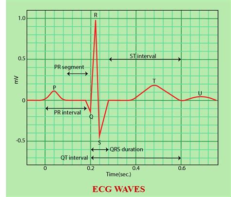 In ECG, the P-R interval corresponds to(a) Time delay in A-V node (b) S-A nodal conduction time ...