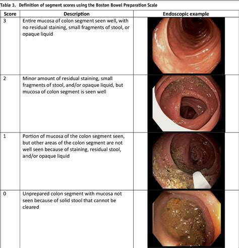 Colonoscopy Preparation