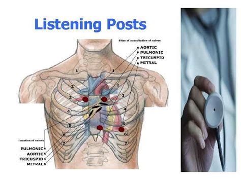 Heart Sounds Murmurs The Stethoscope