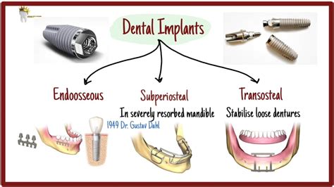 3 Types of Dental Implants and Surface treatments explained! - Dental Clinic