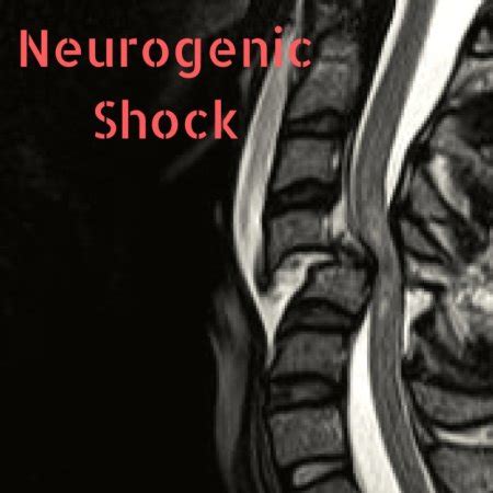 neurogenic shock Archives - Ponder Med