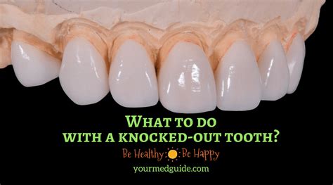 What To Do With a Knocked-Out Tooth? - Your Med Guide