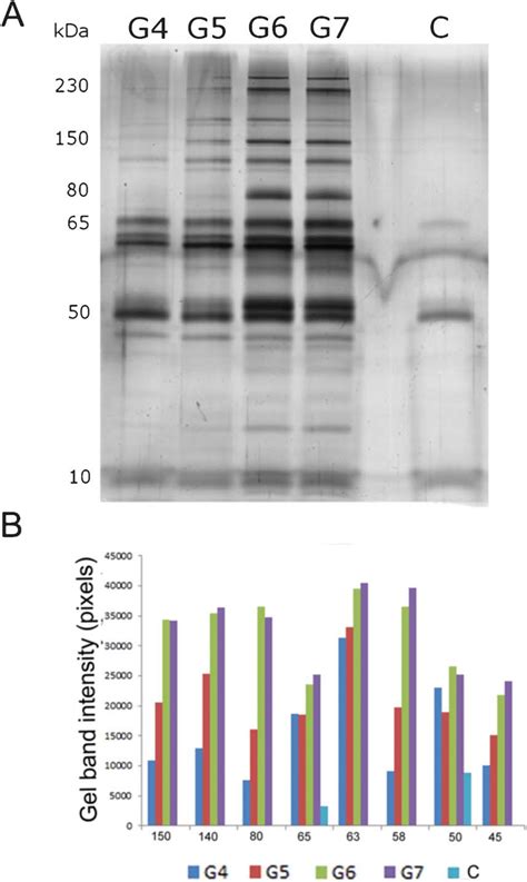 (A) SDS-PAGE of human plasma proteins, in high plasma concentration,... | Download Scientific ...