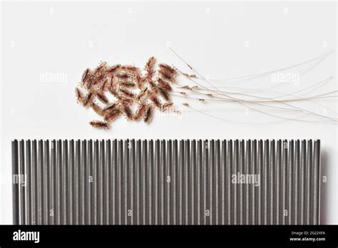 Head lice eggs hi-res stock photography and images - Alamy