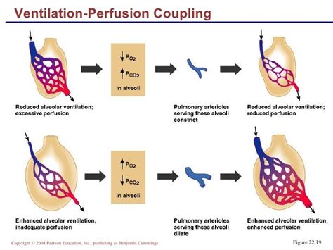 Ventilation Perfusion Coupling