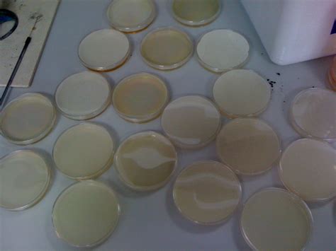 Surrounded by plates of agar… | Lab Work Experience