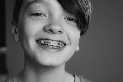 Braces for Kids—How Can Parents Help Their Children? | Pike District Smiles