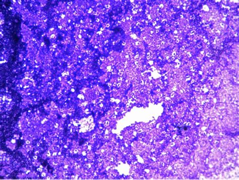 NEGATIVE STAIN – Red Mountain Microbiology