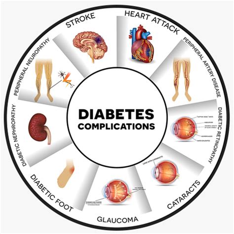 Understanding Diabetic Eye Disease: Symptoms, Treatment, and Prevention - Grosinger, Spigelman ...