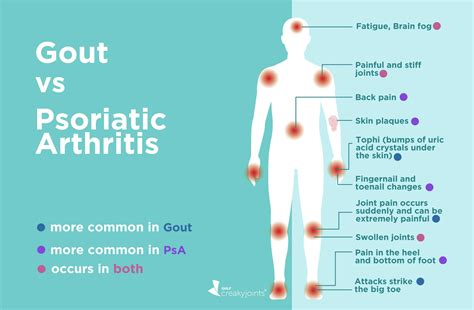 Gout vs. Psoriatic Arthritis: Differences in Symptoms and Treatments