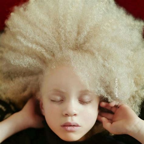 Unique Beauty Of Albino People | DeMilked