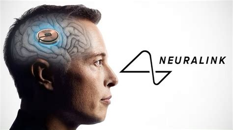 Neuralink brain chip implant trials get FDA approval