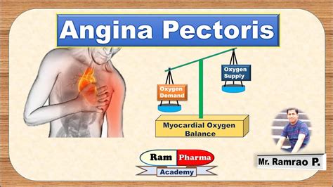 Angina Pectoris (Sign & symptoms and types) - YouTube