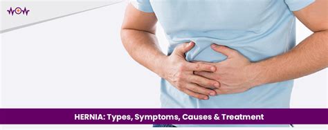 HERNIA: Types, Symptoms, Causes & Treatment - WoW Health Pakistan