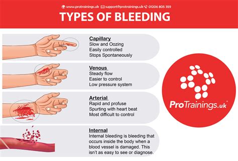 What are the main types of bleeding?