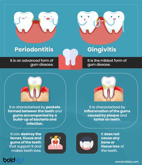 Periodontitis: Symptoms, Causes, Risk factors, Treatment And Prevention - Boldsky.com