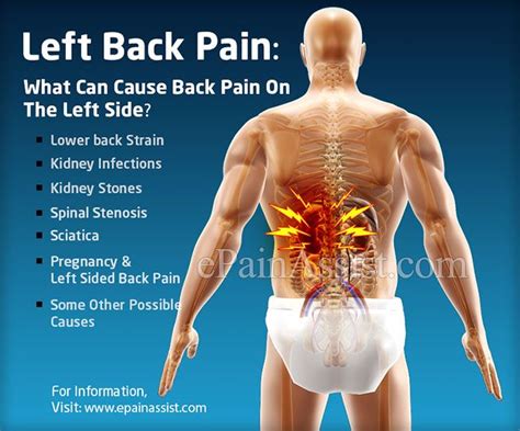 Left Side Female Lower Left Back Pain