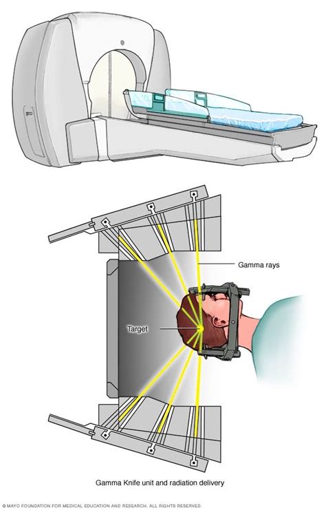 Gamma Ray Therapy - All About Radiation