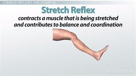 Reflex | Definition, Classification & Examples - Lesson | Study.com