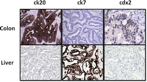 Immunohistochemical analysis. Final immunohistochemical analysis on... | Download Scientific Diagram