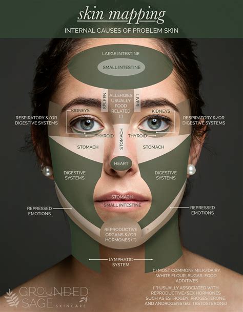 Acne Face Map: Skin Mapping Chart - Pinpoint Internal Causes of Problem ...