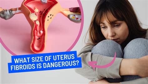 What Size Of Uterus Fibroids Is Dangerous? - Dr Mustafa Aldam ...