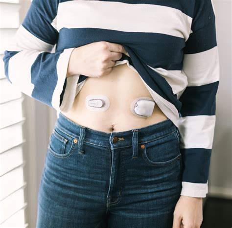 Top Continuous Glucose Monitoring Devices | Milk & Honey Nutrition