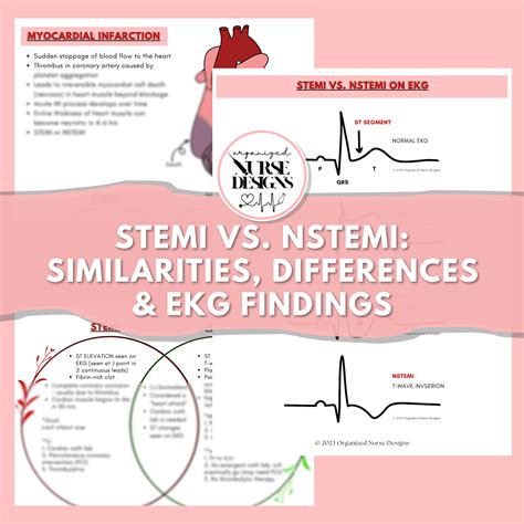 EKG Cardiac Cheat Sheets: STEMI vs. NSTEMI for Nursing Students – OrganizedNurseDesigns