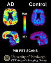 CT Scan vs PET Scan - Difference and Comparison | Diffen