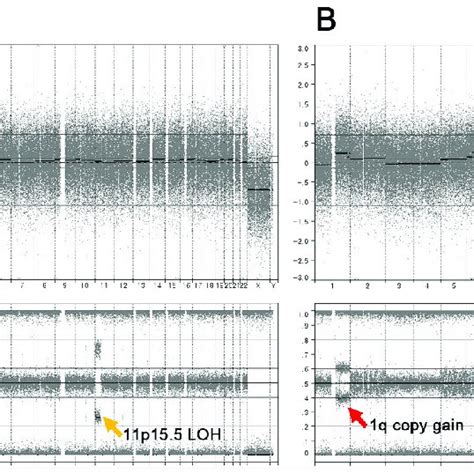 SNP array analysis of both normal (A) and tumor (B) genomes. Both... | Download Scientific Diagram