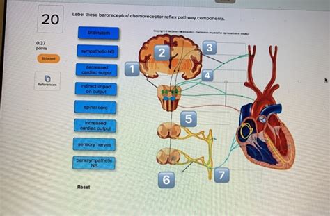 Solved Label these baroreceptor chemoreceptor reflex pathway | Chegg.com