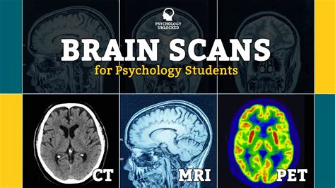 Pet Brain Scan