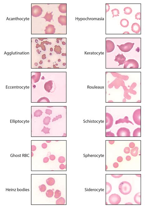 RBC morphology | eClinpath